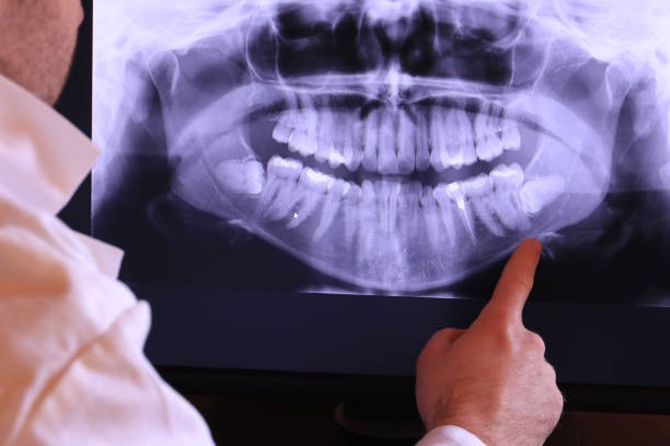 Best Emergency Broken Tooth Repair in State Center, IA