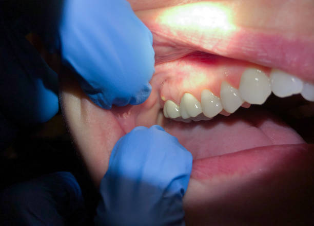 Best Emergency Treatment for Toothache in State Center, IA